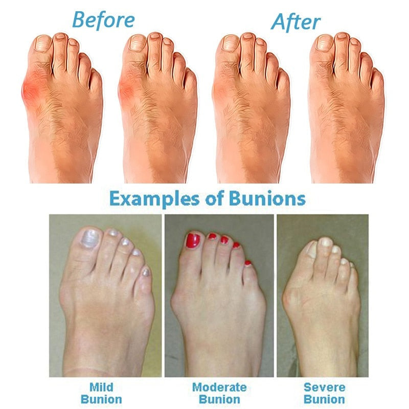 SOLELIA | Corrective sandals for sensitive feet 7